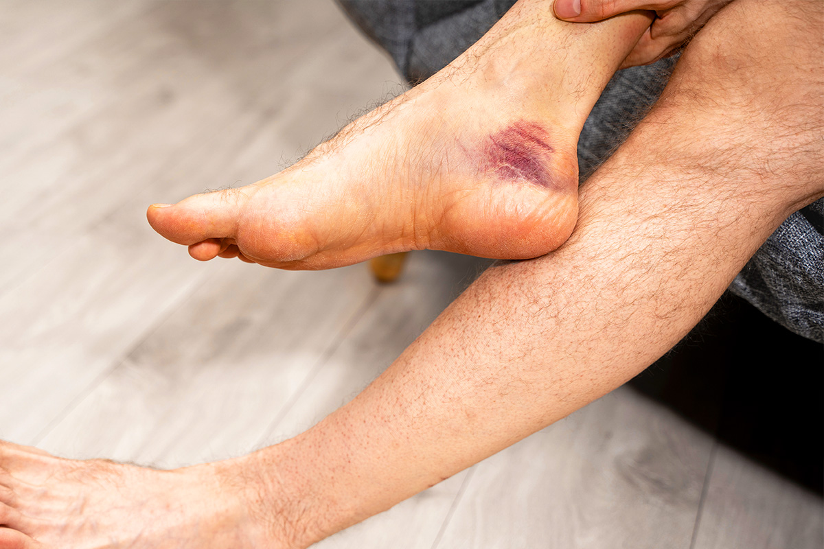 Angiología en Puebla