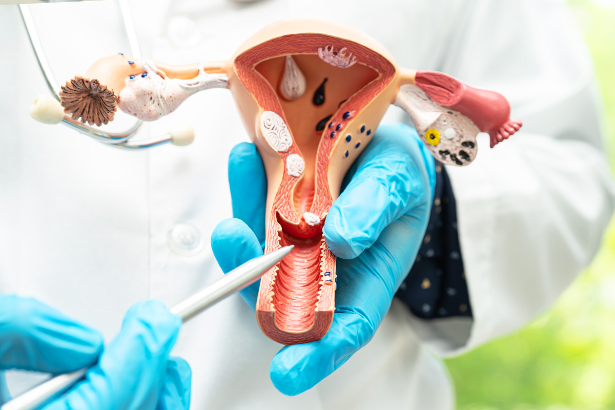 Ginecóloga en Puebla